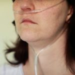 Oxygen care may not be best at home