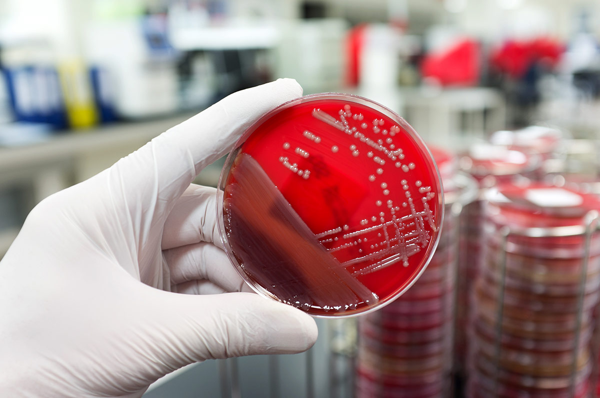 Bacteria growing on an agar petri dish. Stock photo.