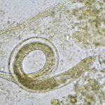 Parasitic worms infect dogs, humans