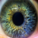 How Toxoplasma parasite damages the human eye