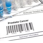 New clues to prostate cancer