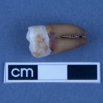 Tooth isotopes offer window into South Australia’s early colonial history