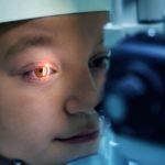 Genetic link in childhood glaucoma