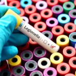 Water tests may fail to detect Legionella